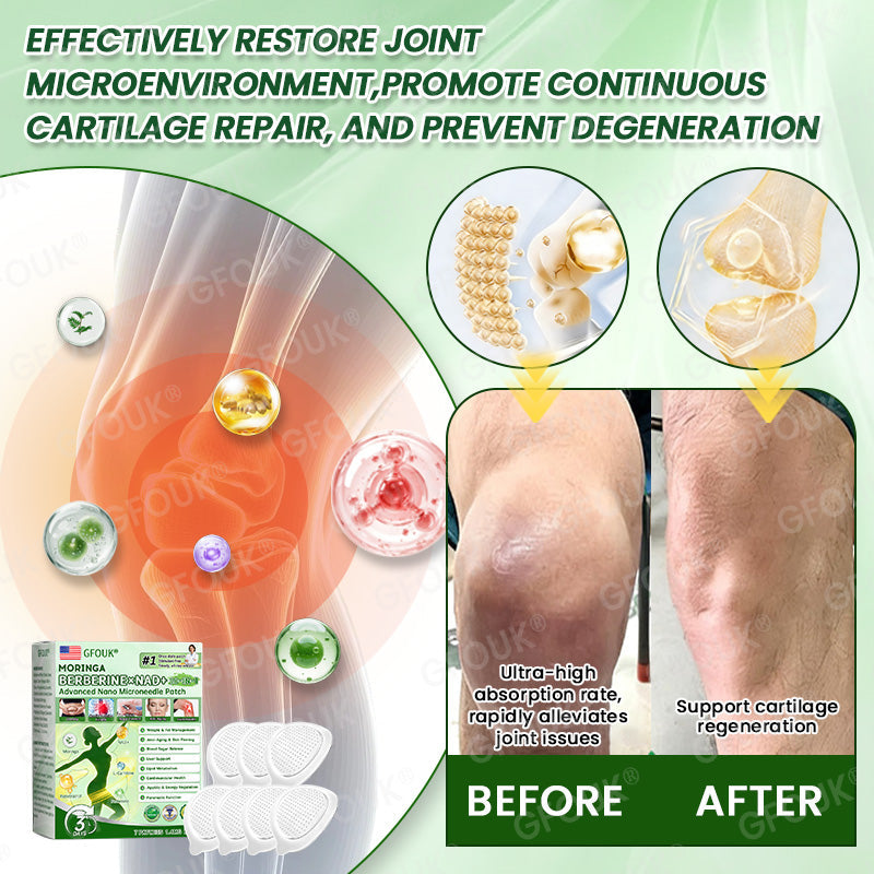 👨‍⚕️🌿𝑶𝒇𝒇𝒊𝒄𝒊𝒂𝒍 𝑺𝒕𝒐𝒓𝒆  | 💫💫Evolvion® 𝑴𝒐𝒓𝒊𝒏𝒈𝗮 · 𝗕𝗲𝗿𝗯𝗲𝗿𝙞𝙣𝙚 × 𝙉𝘼𝐃+ 𝟏𝟎-𝐢𝐧-𝟏 𝗔𝗱𝘃𝗮𝗻𝗰𝙚𝙙 𝙉𝙖𝙣𝙤 𝙈𝙞𝙘𝙧𝙤𝙣𝙚𝙚𝐝𝐥𝐞 𝐏𝐚𝐭𝙘(𝐉𝐮𝐬𝐭 𝐨𝐧𝐜𝐞 𝐚 𝐝𝐚𝐲, 𝐯𝐢𝐬𝐢𝐛𝐥𝐞 𝐜𝐡𝐚𝐧𝐠𝐞𝐬 𝐢𝐧 𝟕 𝐝𝐚𝐲𝐬） ✅ 𝐅𝐨𝐫 𝐨𝐛𝐞𝐬𝐢𝐭𝐲, 🅛🅞🅞🅢🅔 🅢🅚🅘🅝,𝐝𝐢𝐚𝐛𝐞𝐭𝐞𝐬, 𝐬𝐥𝐞𝐞𝐩 𝐚𝐩𝐧𝐞𝐚, 𝐣𝐨𝐢𝐧𝐭 𝐢𝐬𝐬𝐮𝐞𝐬, 𝐚𝐧𝐝 𝐦𝐨𝐫𝐞