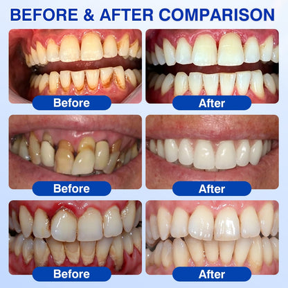 👨‍⚕️☀️🇨🇦🦷Evolvion® GumRevive Periodontal Repair Gel（upsell）