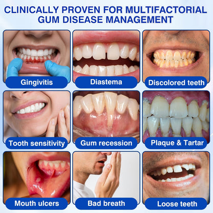 👨‍⚕️☀️🇨🇦🦷Evolvion® GumRevive Periodontal Repair Gel（upsell）