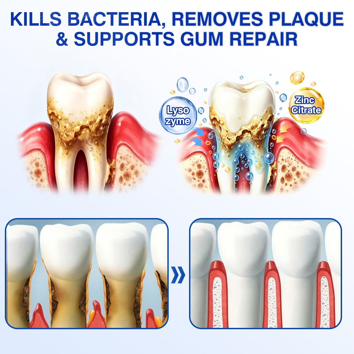 👨‍⚕️☀️🇨🇦🦷Evolvion® GumRevive Periodontal Repair Gel（upsell）
