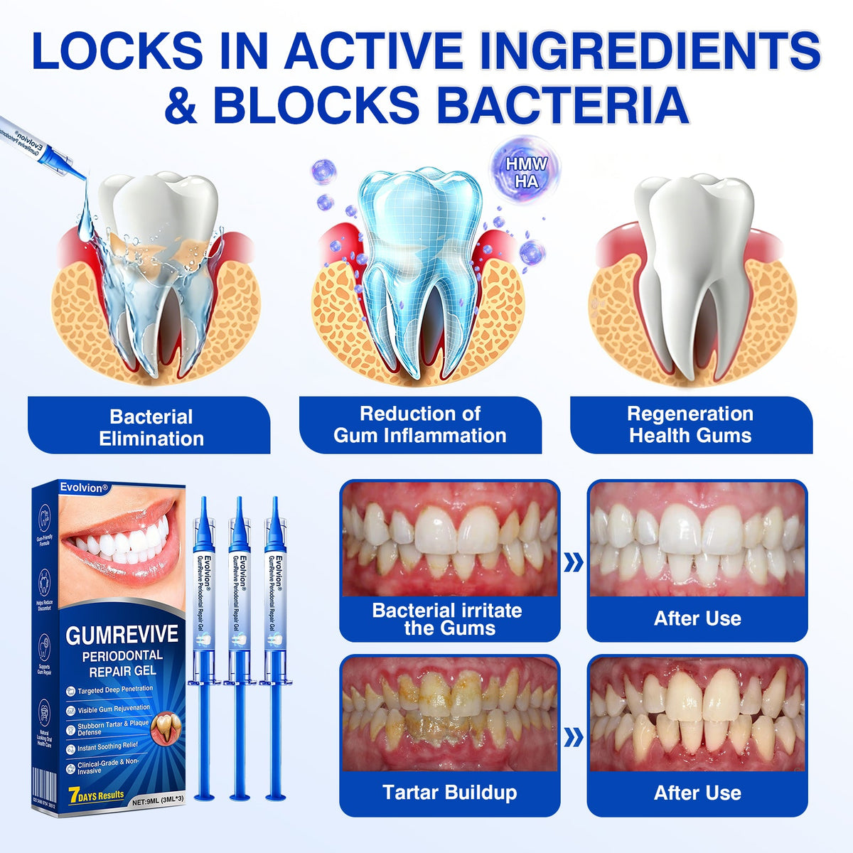 👨‍⚕️☀️🇨🇦🦷Evolvion® GumRevive Periodontal Repair Gel（upsell）