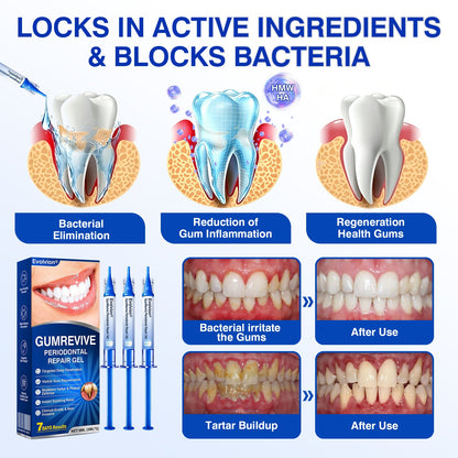 👨‍⚕️☀️🇨🇦🦷Evolvion® GumRevive Periodontal Repair Gel（upsell）