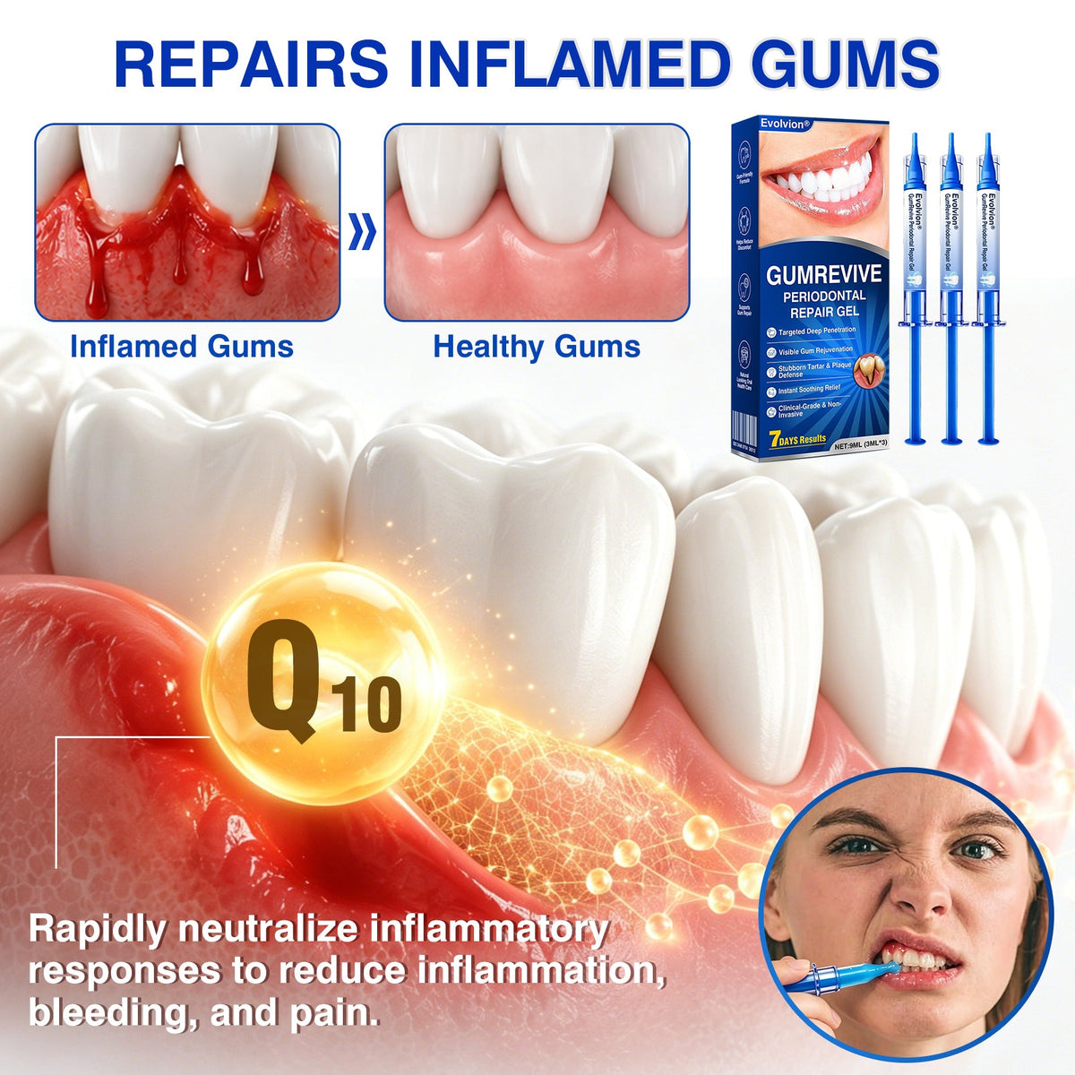 👨‍⚕️☀️🇨🇦🦷Evolvion® GumRevive Periodontal Repair Gel（upsell）