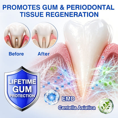 👨‍⚕️☀️🇨🇦🦷Evolvion® GumRevive Periodontal Repair Gel（upsell）