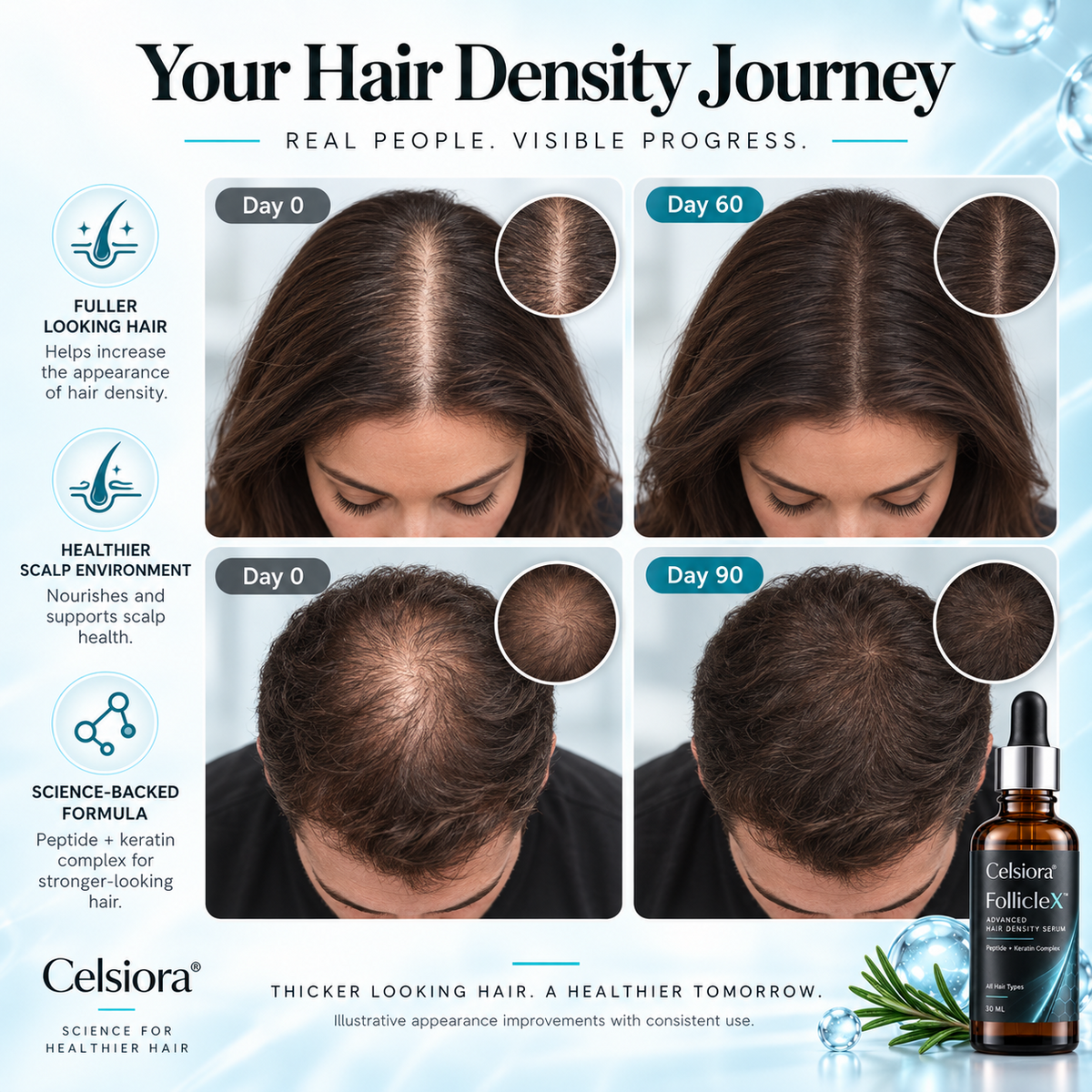 Celsiora® FollicleX™ Advanced Hair Density Serum
