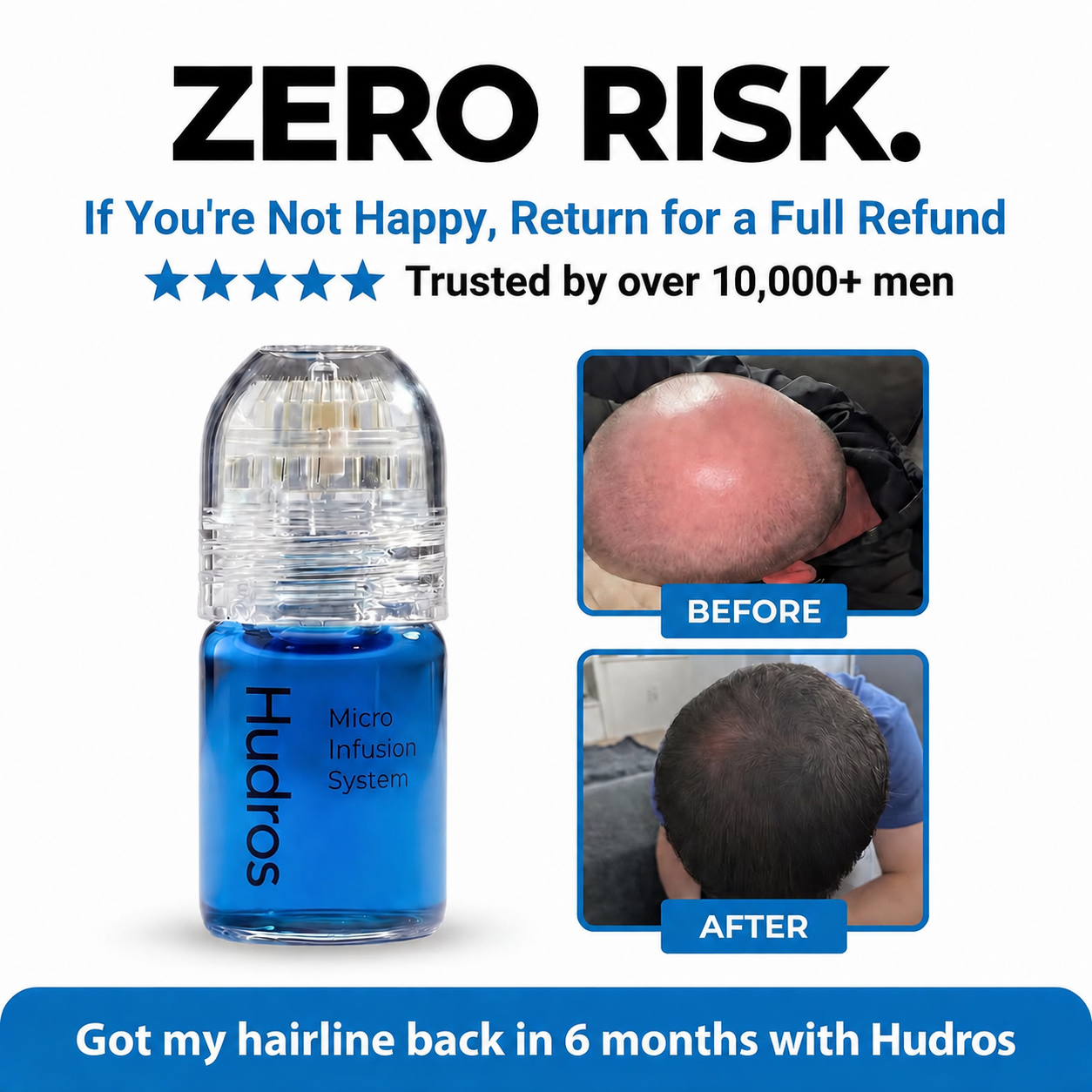 😄💉Micro-Infusion Peptide System For Hair Regrowth.